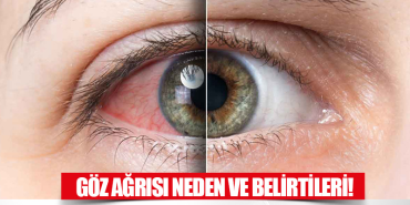 Ağrı göz sağlığı: ambliyopi farkındalığı projesi